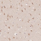 Immunohistochemical staining of human cerebral cortex shows high expression.