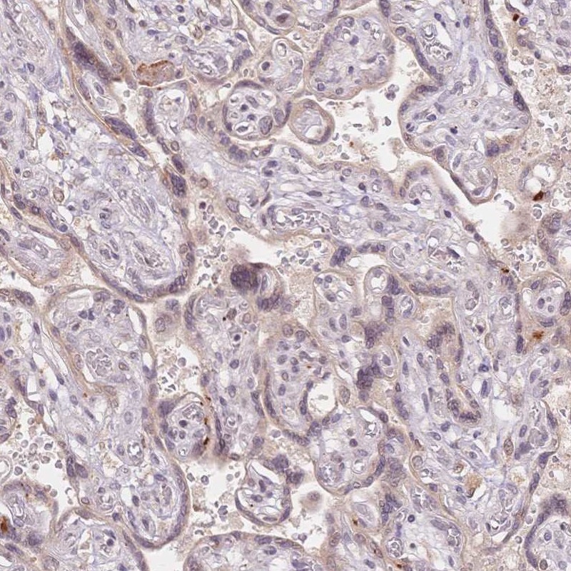 Rabbit Polyclonal Anti-STK39 Antibody - Buy for research - Highly ...