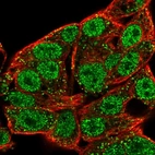 Immunofluorescent staining of human cell line Hep G2 shows localization to nucleoplasm & vesicles.
