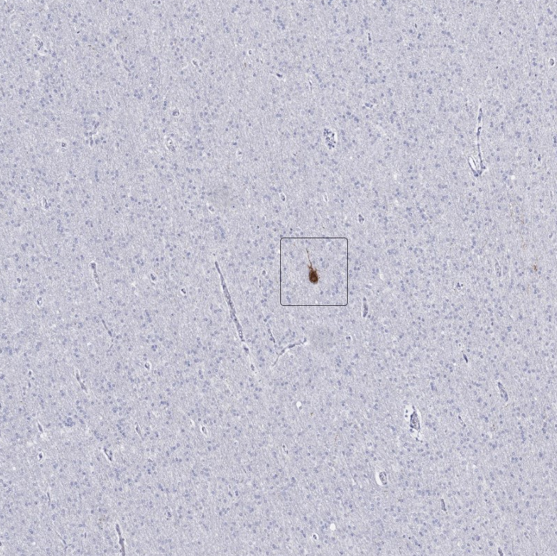 Anti-CALHM1 Antibody