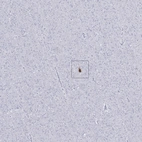 Anti-CALHM1 Antibody