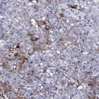 Immunohistochemical staining of human adrenal gland shows moderate cytoplasmic positivity in a subset of glandular cells in medulla.