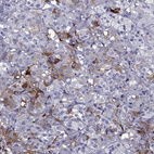 Anti-CALHM1 Antibody