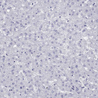 Anti-CALHM1 Antibody