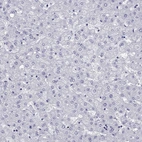 Immunohistochemical staining of human liver shows no cytoplasmic positivity in hepatocytes as expected.