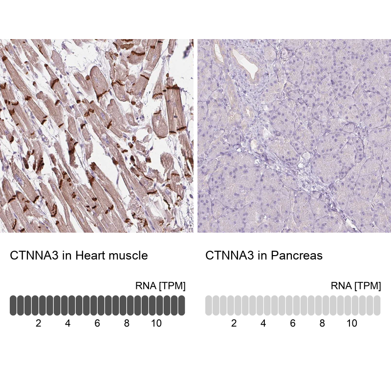 Anti-CTNNA3 Antibody