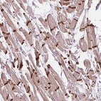 Immunohistochemical staining of human heart muscle shows high expression.