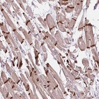 Anti-CTNNA3 Antibody