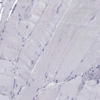 Immunohistochemical staining of human skeletal muscle shows no cytoplasmic positivity in myocytes as expected.