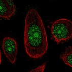 Anti-ZNF16 Antibody