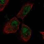 Anti-PTTG1IP Antibody