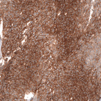 Anti-FXYD5 Antibody