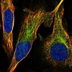 Immunofluorescent staining of human cell line U-2 OS shows localization to cytosol.