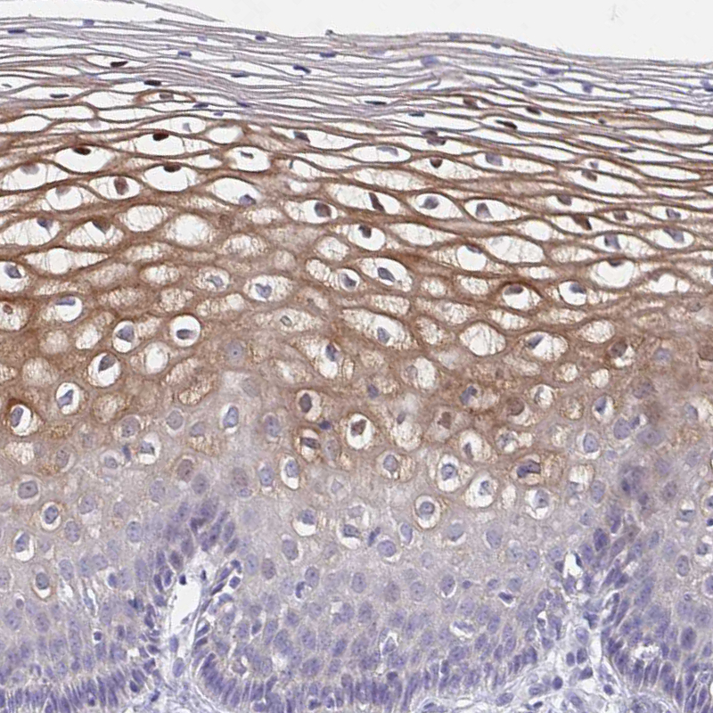 Anti-CDC42BPG Antibody