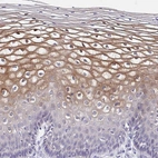 Anti-CDC42BPG Antibody