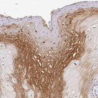 Immunohistochemical staining of human oral mucosa shows positivity in epidermal cells.