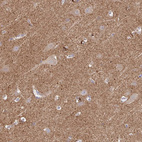 Immunohistochemical staining of human cerebral cortex shows positivity in neuropil.
