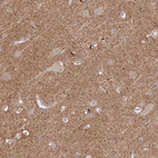Immunohistochemical staining of human cerebral cortex shows positivity in neuropil.