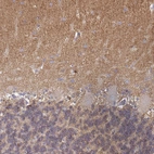 Immunohistochemical staining of human cerebellum shows positivity in neuropil.