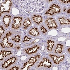 Anti-BBS12 Antibody