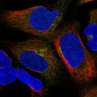 Immunofluorescent staining of human cell line HEK 293 shows localization to cytosol & the Golgi apparatus.