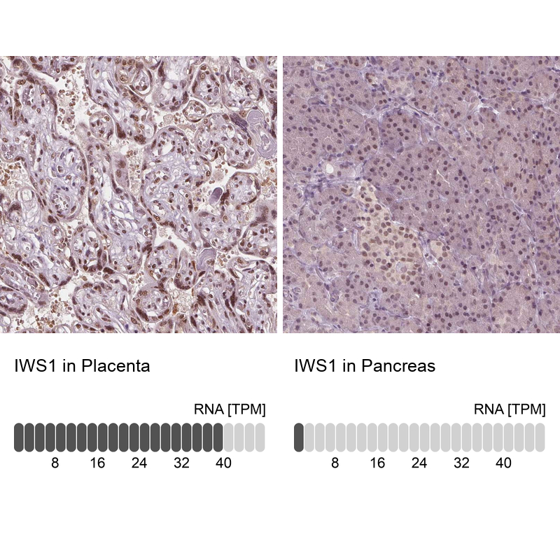 Anti-IWS1 Antibody