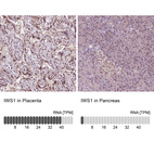 Anti-IWS1 Antibody