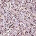 Anti-IWS1 Antibody