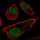 Anti-PRPF31 Antibody