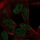 Anti-CTHRC1 Antibody