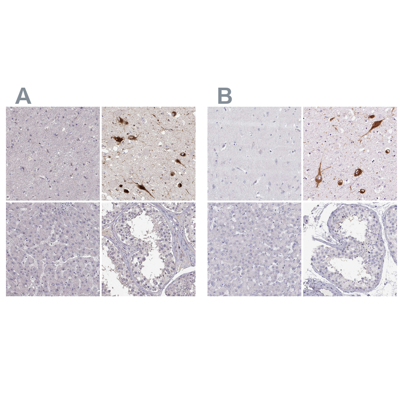 Anti-PMCH Antibody