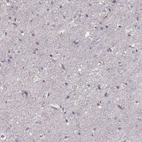 Immunohistochemical staining of human cerebral cortex shows no positivity in neurons as expected.