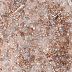 Anti-FXYD5 Antibody