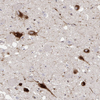 Anti-PMCH Antibody