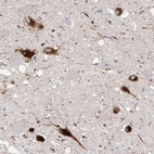 Immunohistochemical staining of human hypothalamus using Anti-PMCH antibody HPA061884.