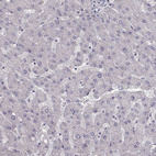 Immunohistochemical staining of human liver shows no positivity in hepatocytes as expected.