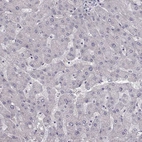 Immunohistochemical staining of human liver shows no positivity in hepatocytes as expected.