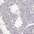 Immunohistochemical staining of human testis shows no positivity in cells in seminiferous ducts as expected.