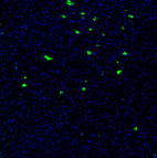 Immunofluorescence staining of mouse brain shows strong positivity in of neurons in the hypothalamus.
