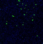 Immunofluorescence staining of mouse brain shows strong positivity in of neurons in the hypothalamus.