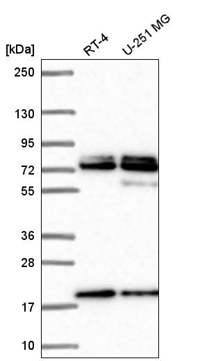 Anti-NUP85 Antibody