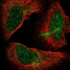 Immunofluorescent staining of human cell line U-2 OS shows localization to nucleoplasm & cytosol.