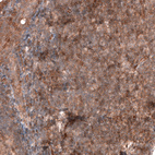 Immunohistochemical staining of human tonsil shows moderate membranous positivity in lymphoid cells.