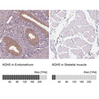 Anti-ADH5 Antibody