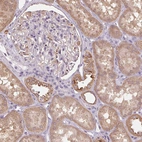 Immunohistochemical staining of human kidney shows moderate cytoplasmic positivity in cells in tubules.