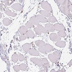 Immunohistochemical staining of human skeletal muscle shows low positivity in myocytes as expected.