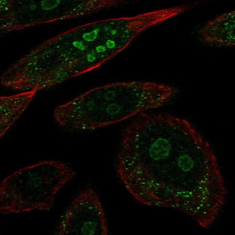 Anti-BRINP2 Antibody