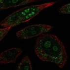 Anti-BRINP2 Antibody