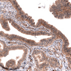 Immunohistochemical staining of human fallopian tube shows moderate membranous and cytoplasmic positivity in glandular cells.