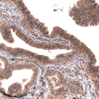 Anti-FXYD5 Antibody